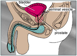 auroh homeopathy prostate