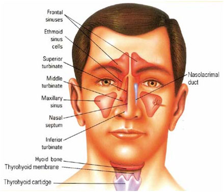 what causes a maxillary sinus contamination