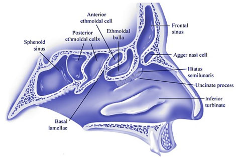 auroh homeopathy sinusitis