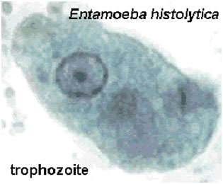 auroh homeopathy amoebiasis - entamoeba histolytica  and trophozoite