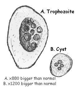 auroh homeopathy amoebiasis - trophozoite and cyst