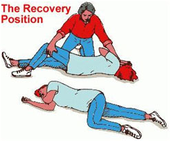 auroh homeopathy epilepsy - epilepsy recovery position