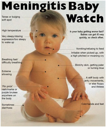 auroh homeopathy meningitis - meningitis baby watch